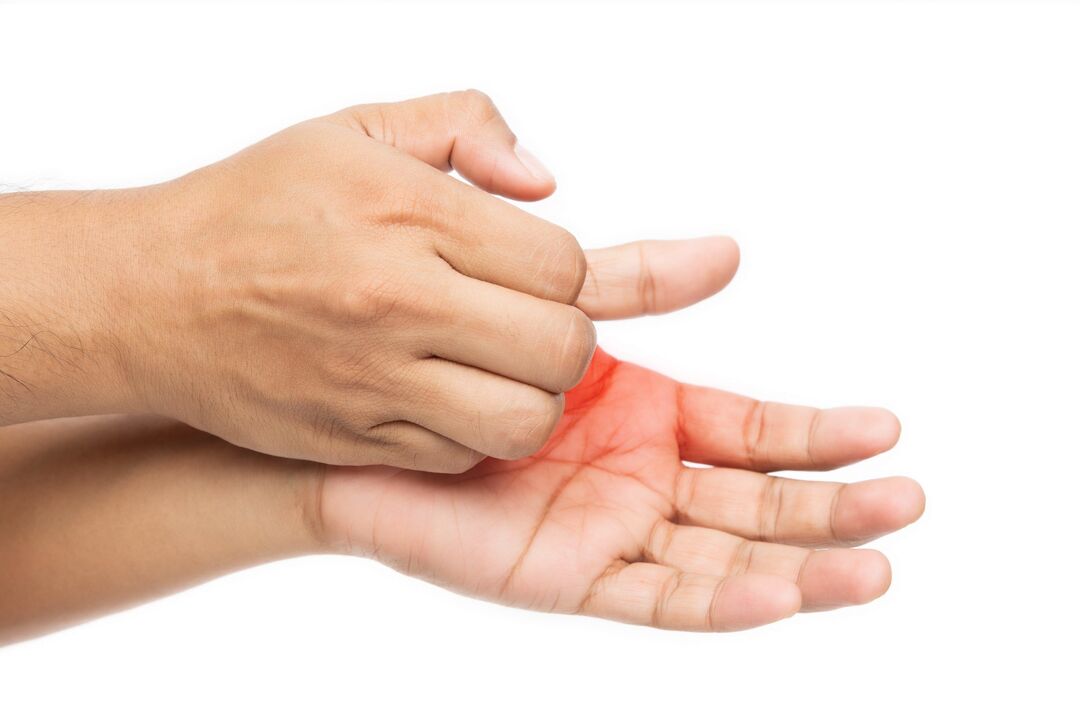 Sügelus seen ja selle ravi demyxil -kreemiga